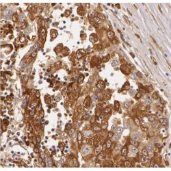 Rho-Related GTP-Binding Protein RhoE (RND3) Antibody