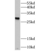 WB analysis of fetal human brain tissue, using RND3 antibody (1/1000 dilution).