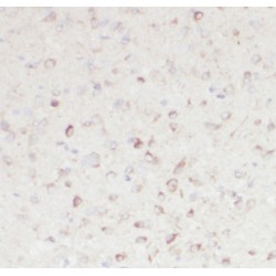 Ring Finger Protein 10 (RNF10) Antibody