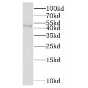 WB analysis of mouse lung tissue, using RNF150 antibody (1/500 dilution).