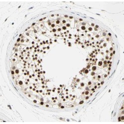 Ring Finger Protein 17 (RNF17) Antibody