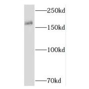 WB analysis of human testis tissue, using RNF17 antibody (1/600 dilution).