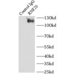 Ring Finger Protein 20 (RNF20) Antibody