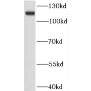 WB analysis of HeLa cells, using RNF20 antibody (1/500 dilution).