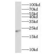 WB analysis of human heart tissue, using RNF212 antibody (1/500 dilution).