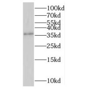 WB analysis of human testis tissue, using RNF41 antibody (1/500 dilution).