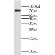 WB analysis of HeLa cells, using RNPEP antibody (1/500 dilution).
