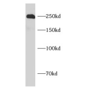 WB analysis of mouse brain tissue, using ROBO1-Specific antibody (1/1000 dilution).