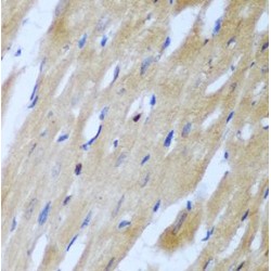 Rho-Associated Protein Kinase 1 (ROCK1) Antibody