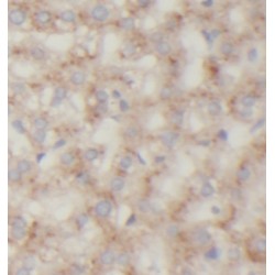 Rho-Associated Protein Kinase 2 (ROCK2) Antibody