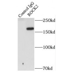 Rho-Associated Protein Kinase 2 (ROCK2) Antibody