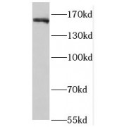 WB analysis of HT-1080 cells, using ROCK2 antibody (1/1000 dilution).