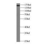 WB analysis of HeLa cells, using ROCK2-Specific (C-term) antibody (1/400 dilution).