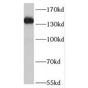 WB analysis of mouse lung tissue, using RON, MST1R antibody (1/300 dilution).