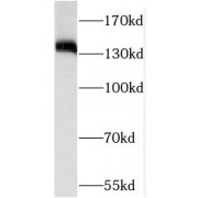 WB analysis of K-562 cells, using ROR1 antibody (1/500 dilution).
