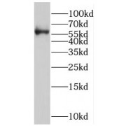 WB analysis of Jurkat cells, using RORC antibody (1/1000 dilution).