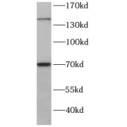 WB analysis of HEK-293 cells, using RPGRIP1 antibody (1/400 dilution).