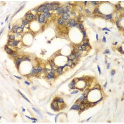 Rabphilin 3A (RPH3A) Antibody