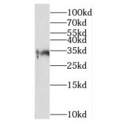 WB analysis of mouse spleen tissue, using RPIA antibody (1/1500 dilution).