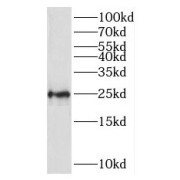 WB analysis of mouse thymus tissue, using RPL10 antibody (1/500 dilution).