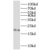 WB analysis of human liver tissue, using RPL11 antibody (1/500 dilution).