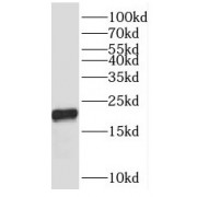 WB analysis of HeLa cells, using RPL12 antibody (1/400 dilution).