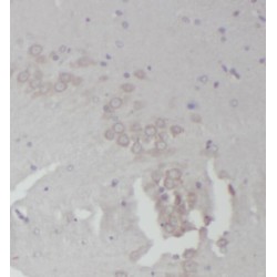 Ribosomal Protein L18A (RPL18A) Antibody