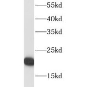 WB analysis of Jurkat cells, using RPL18A antibody (1/500 dilution).