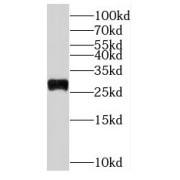 WB analysis of HeLa cells, using RPL19 antibody (1/500 dilution).