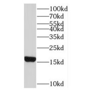 WB analysis of A431 cells, using RPL22 antibody (1/600 dilution).