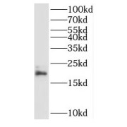 WB analysis of HepG2 cells, using RPL23A antibody (1/500 dilution).