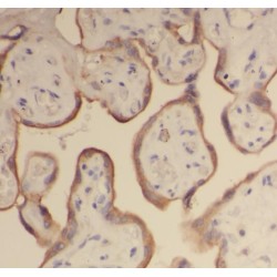 Ribosomal Protein L24 (RPL24) Antibody