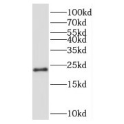 WB analysis of Jurkat cells, using RPL24 antibody (1/500 dilution).