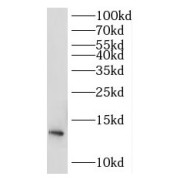 WB analysis of A549 cells, using RPL30 antibody (1/500 dilution).