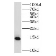 WB analysis of HepG2 cells, using RPL31 antibody (1/300 dilution).