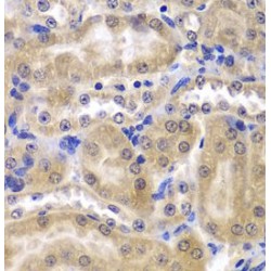 Ribosomal Protein L5 (RPL5) Antibody