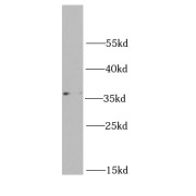 WB analysis of HepG2 cells, using RPL5 antibody (1/1000 dilution).