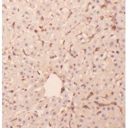 Ribosomal Protein L6 (RPL6) Antibody