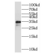 WB analysis of HepG2 cells, using RPL6 antibody (1/500 dilution).