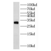 WB analysis of MCF7 cells, using RPL7A antibody (1/500 dilution).