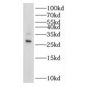 WB analysis of HepG2 cells, using RPL7L1 antibody (1/1000 dilution).