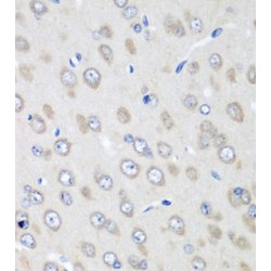 Dolichyl-Diphosphooligosaccharide-Protein Glycosyltransferase Subunit 2 (RPN2) Antibody