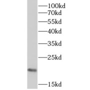 WB analysis of COLO 320 cells, using RPP21 antibody (1/600 incubated at room temperature for 1.5 hours dilution).