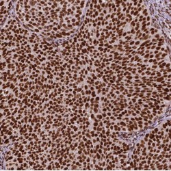 Ribonuclease P And MRP Subunit P25 (RPP25) Antibody