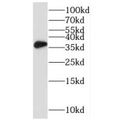 WB analysis of HeLa cells, using RPRD1B antibody (1/1000 dilution).