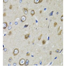 Ribosomal Protein S10 (RPS10) Antibody