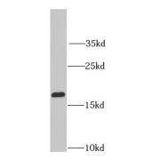 WB analysis of Raji cells, using RPS10 antibody (1/1000 dilution).