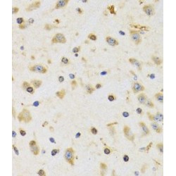 Ribosomal Protein S12 (RPS12) Antibody