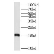 WB analysis of MCF7 cells, using RPS20 antibody (1/500 dilution).