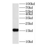 WB analysis of Jurkat cells, using RPS25 antibody (1/1000 dilution).
